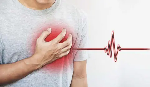 Síndrome del corazón roto  : una afección cardíaca más seria que una simple metáfora 